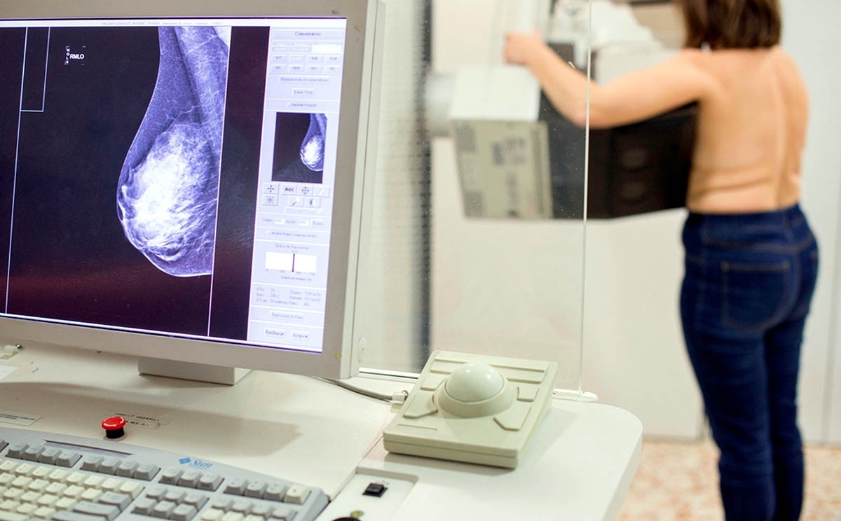 Una dona fent-se una mamografia