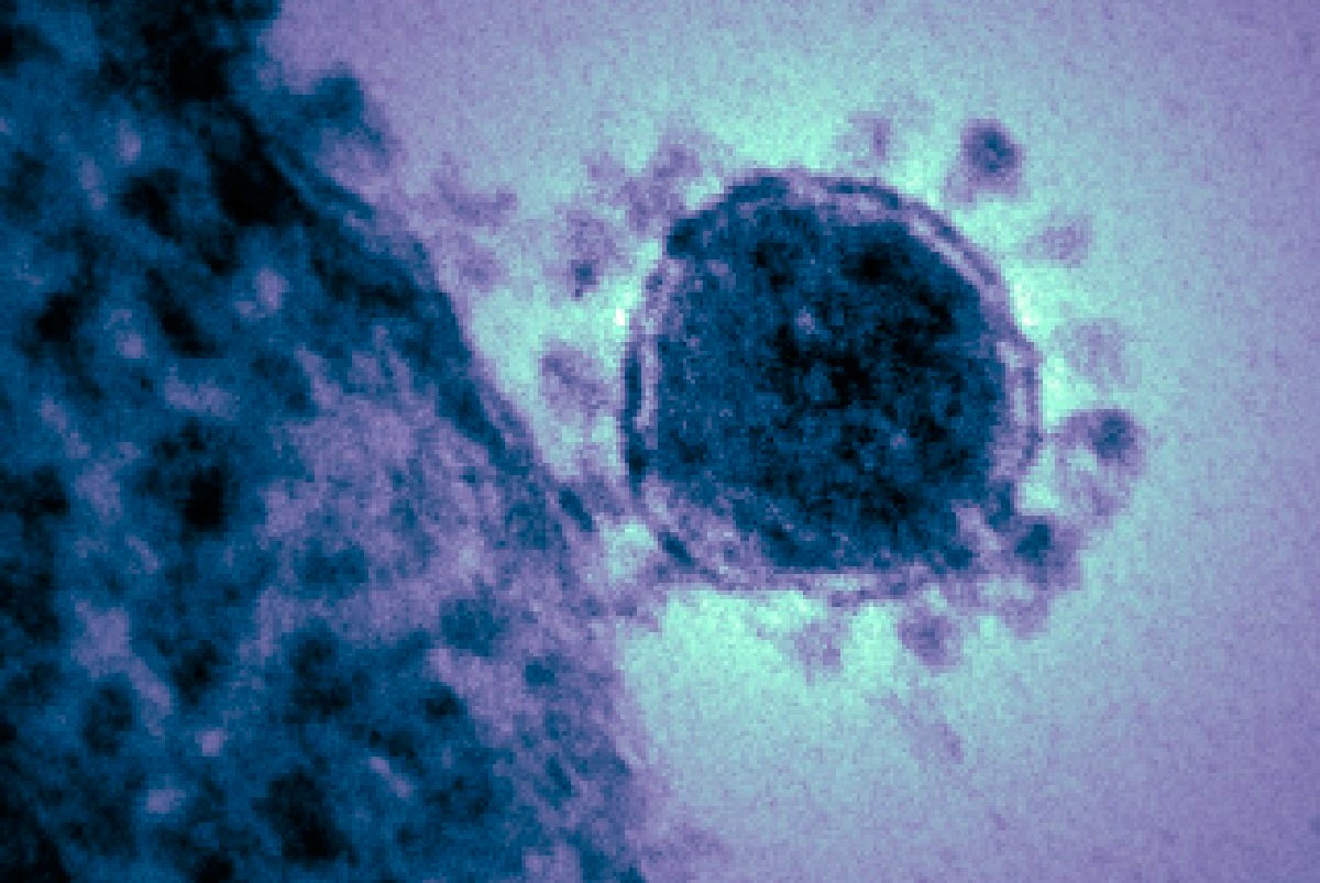 Imatge d'arxiu d'un virus.