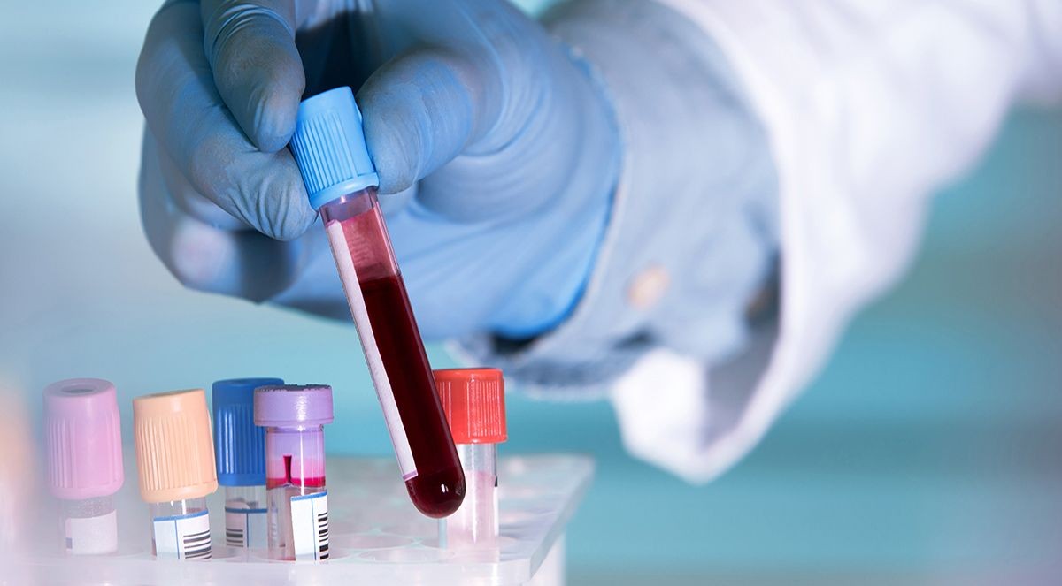 Una mostra de sang en un laboratori.