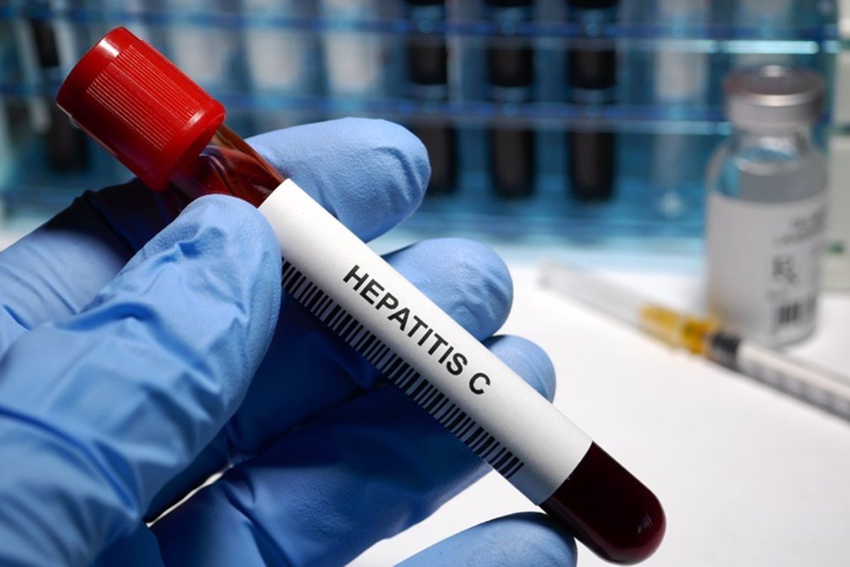 L'hepatitis C podria tenir cura en menys de 10 anys