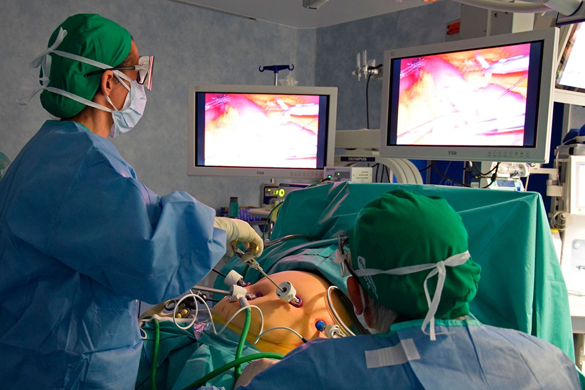 Una intervenció de cirurgia bariàtrica a l'Hospital de Vic