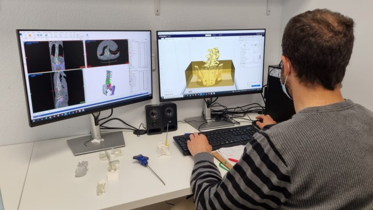 Un dels membres del laboratori 3D Atmosfera de l'Hospital de Tortosa Verge de la Cinta treballant en el disseny de models anatòmics 
