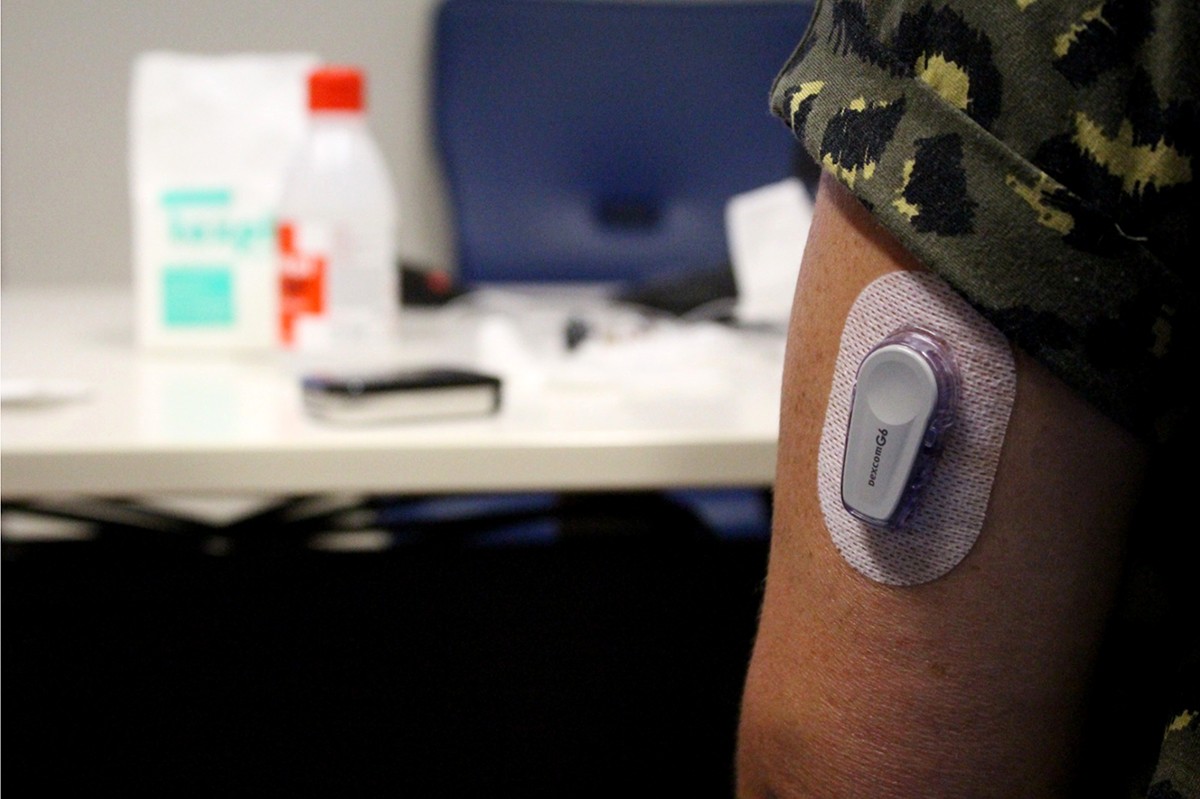 Un sensor de nivells de glucosa al braç d'un pacient.