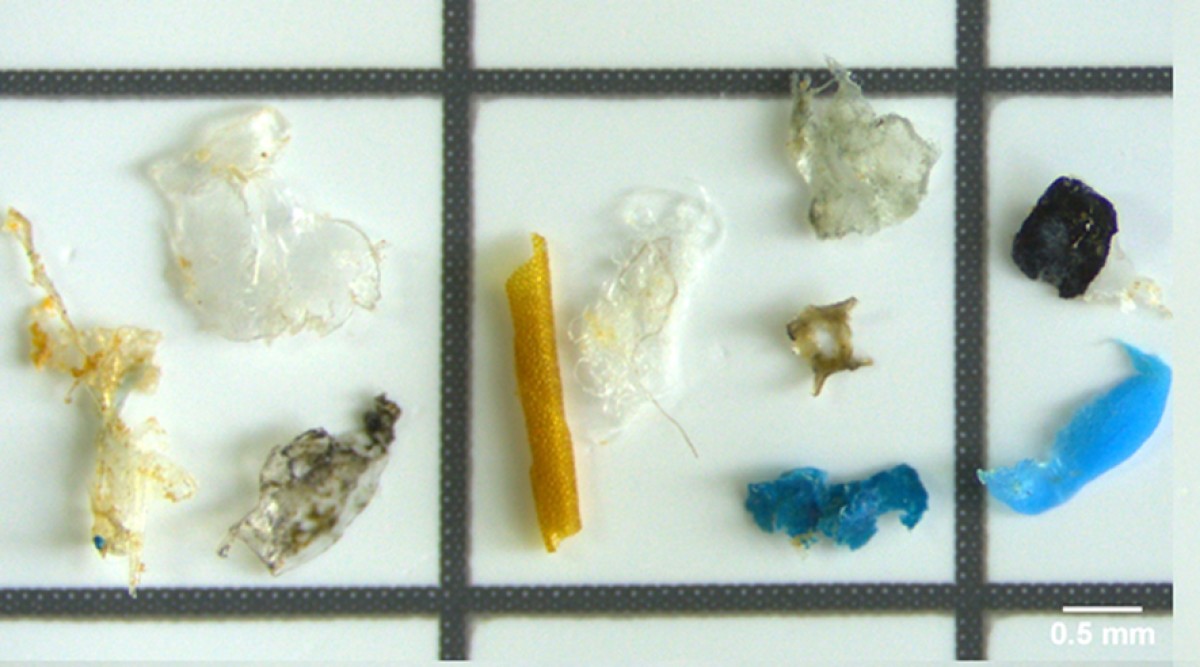 Detall ampliat d'una mostra de microplàstics filtrats 