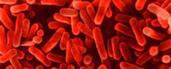 Una imatge del bacteri de la legionel·la
